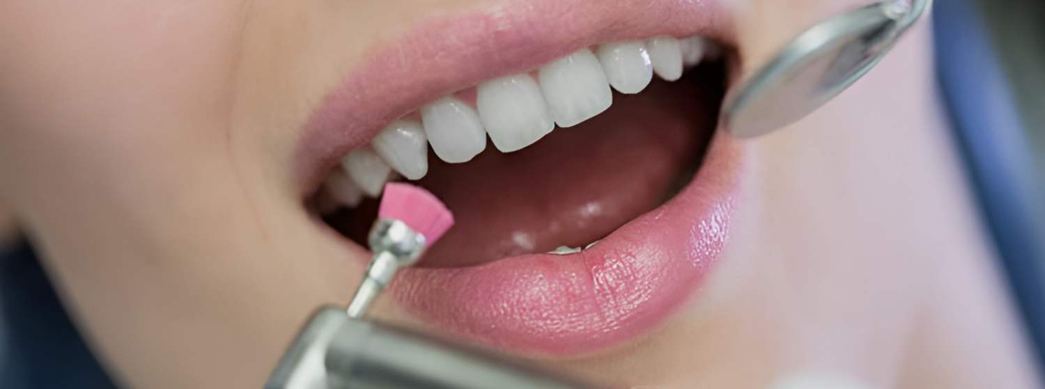 Чистка Air flow Чистка Air flow