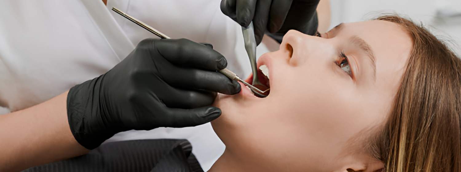 Удаление зубного камня