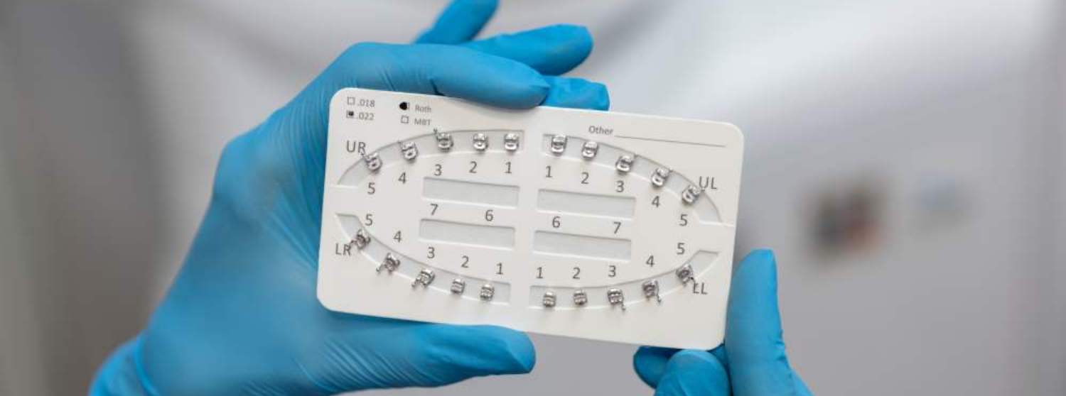 Установка брекетов