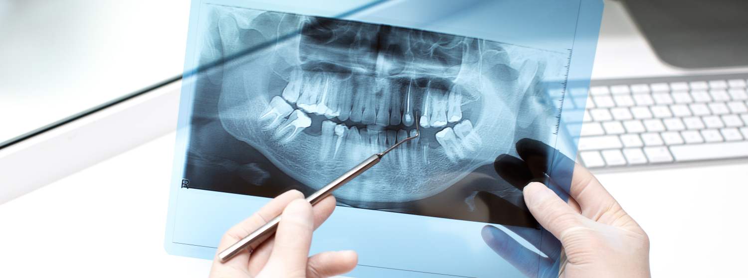 Компьютерная томография Компьютерная томография