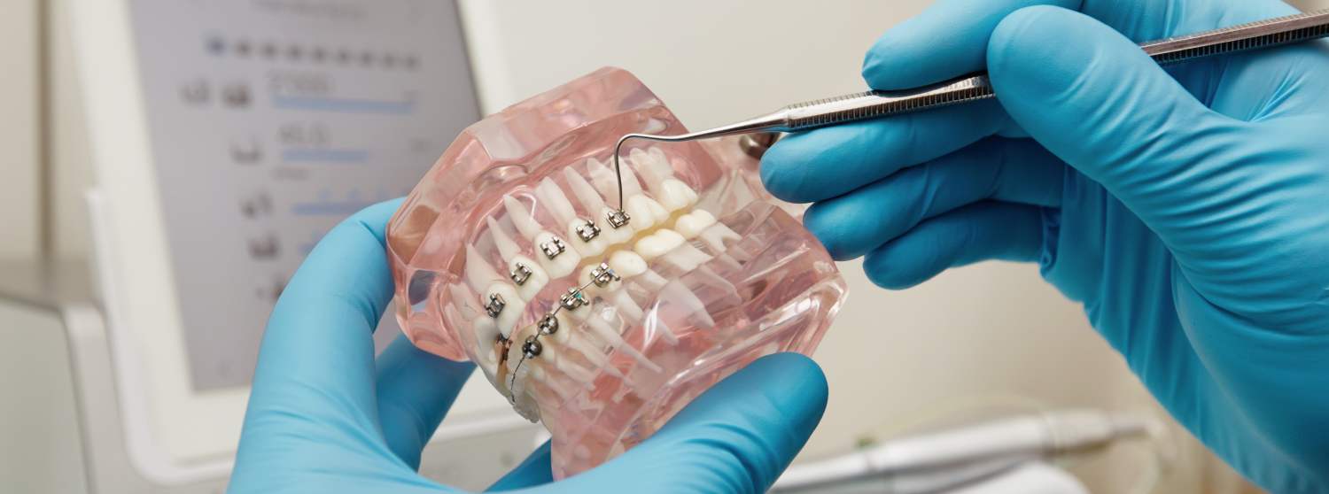 Консультация стоматолога-ортодонта