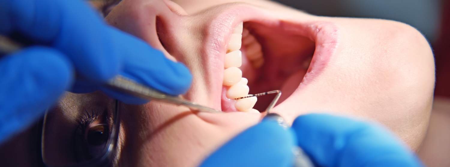 Лечение подвижности зубов Лечение подвижности зубов