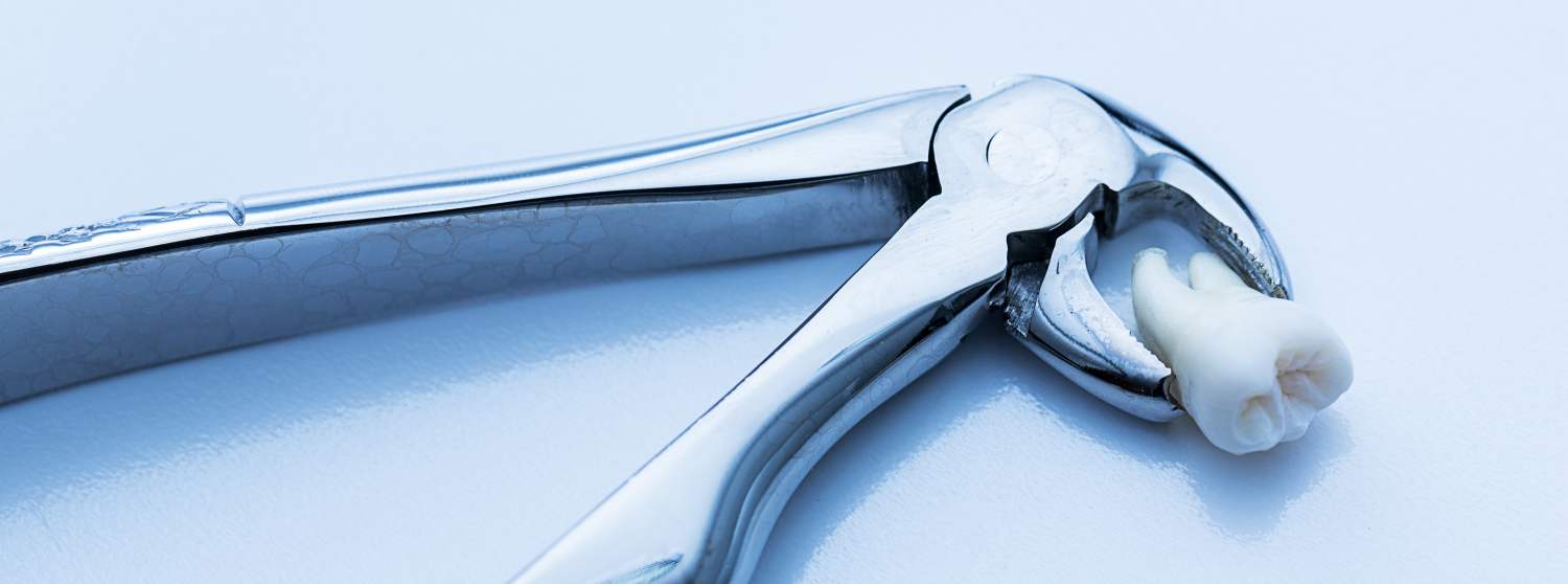 Удаление зубов