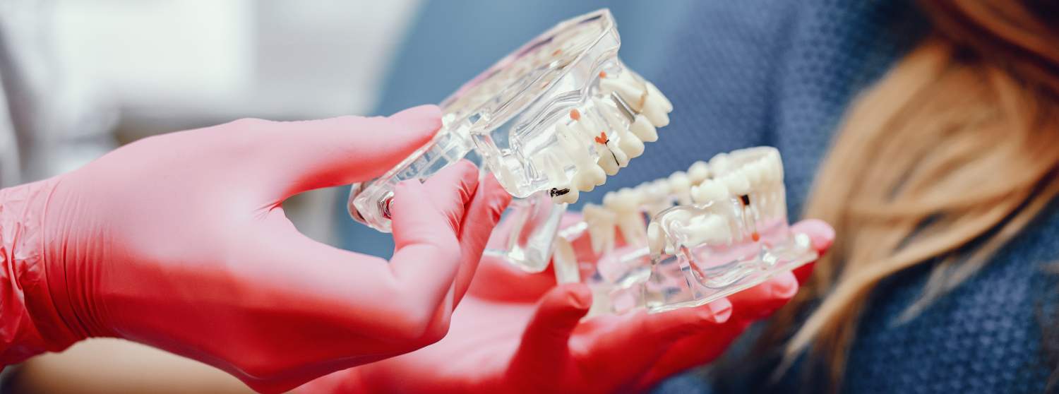 Протезирование зубов Протезирование зубов