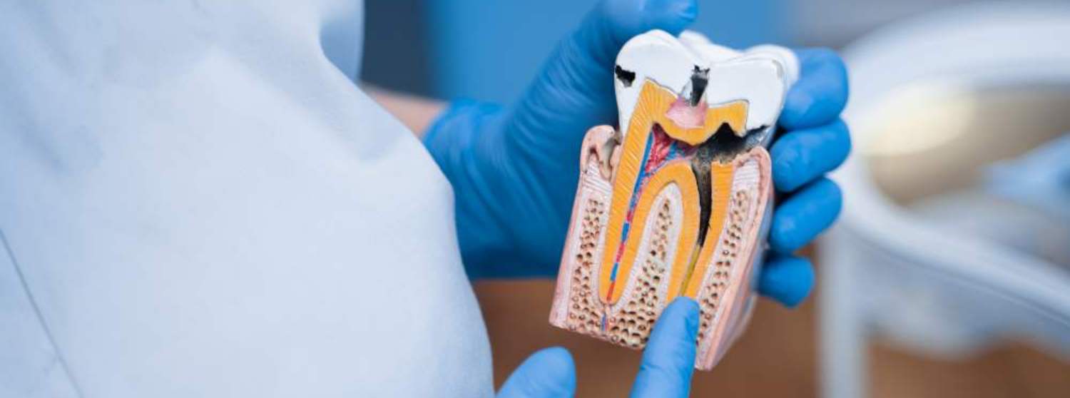 Лечение пульпита у детей Лечение пульпита у детей