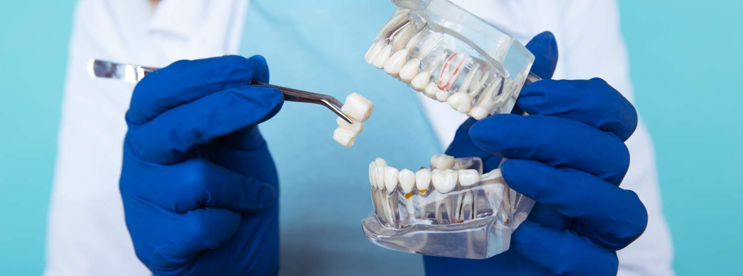 Циркониевые коронки на имплант с установкой