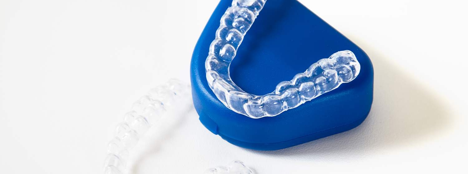 Каппы Каппы