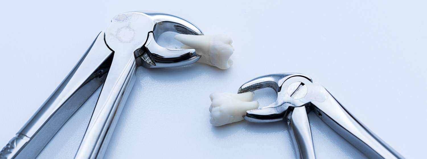 Удаление постоянных зубов под наркозом